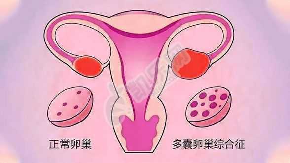 东方助孕官网,三种试管婴儿生殖辅助技术，看看哪种适合你？